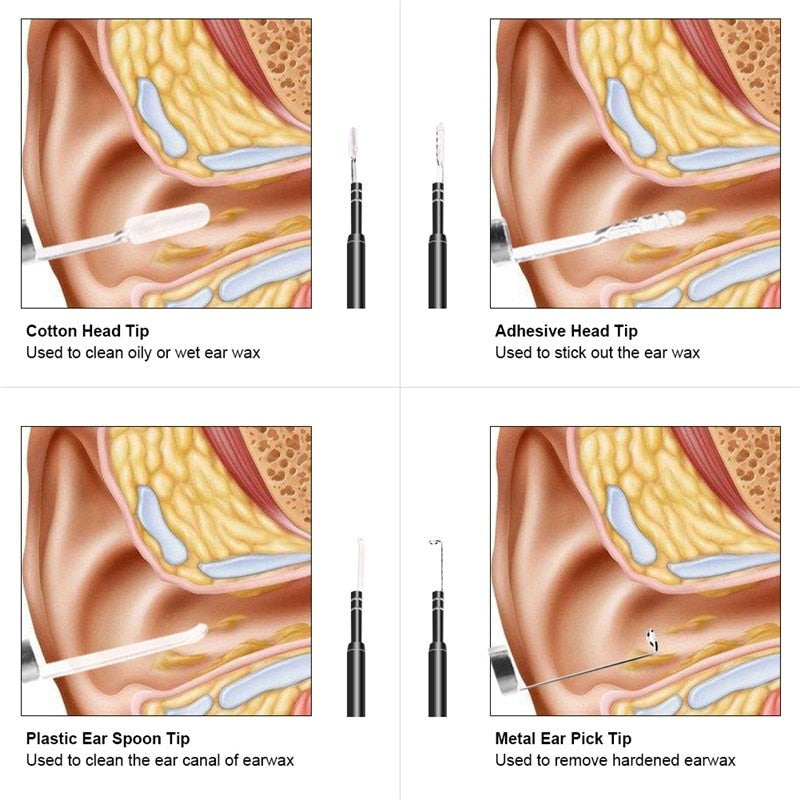 HD Otoscope Camera - Micro USB, USB, USB Type-C